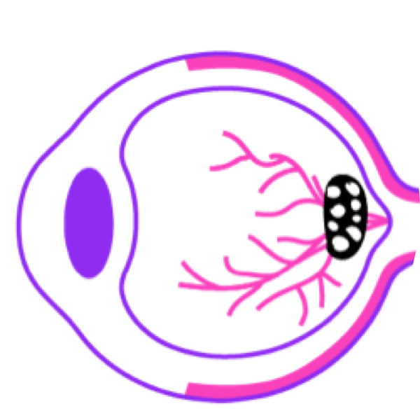 איור המדגים AMD רטוב